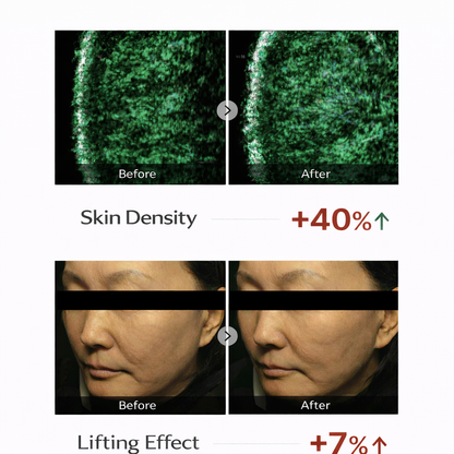 House of B Glutathione Peel – Korean Top-Line 2-Step Professional Renewal | 4 Count